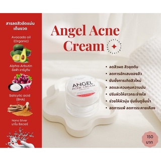 Angel Acne Cream  แองเจิ้ล แอคเน่ครีม ลดสิวปรับผิวหน้าให้กระจ่างใส