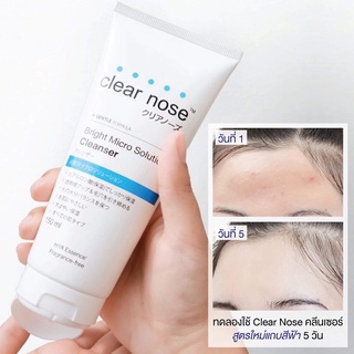 (1หลอด) โฟม Clear nose แอคเน่ แคร์ คลีนเซอร์เคลียร์โนส 150 ml.สีฟ้า