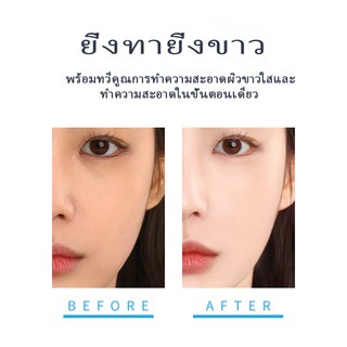 ไนอาซินาไมด์ไวท์เทนนิ่งให้ความชุ่มชื้นและซ่อมแซมหน้ากากไหมขายส่ง