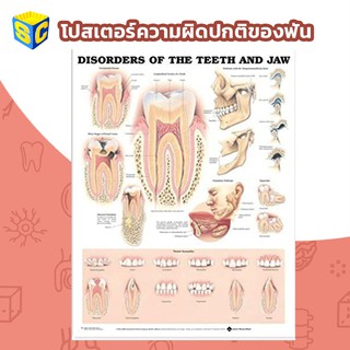 โปสเตอร์ฟัน ความผิดปกติของฟัน The Teeth Poster