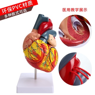 โมเดลหุ่นอนาโตมี่ 1:1Human Heart Anatomy Model BUltrasound Detachable Natural Large Heart Medical Teaching Model