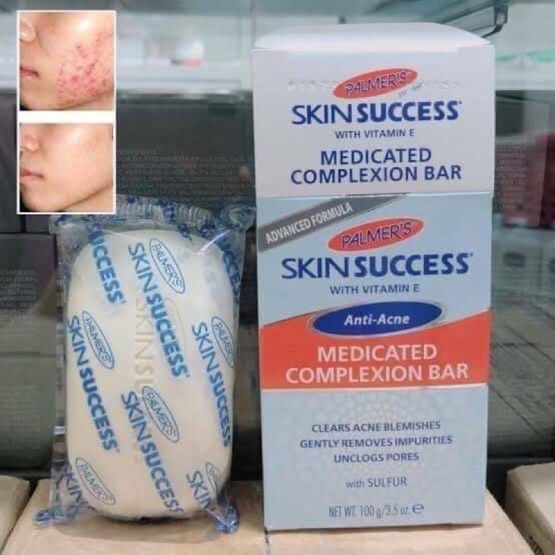 สบู่ สิว Palmer’s skin success anti acne medicated complexion bar 100g.  สบู่ลดสิว จาก USAนำเข้าจากอ