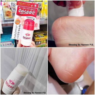 kobayashi pharmaceutical smooth and sticks 30g./ทาส้นเท้าแตก