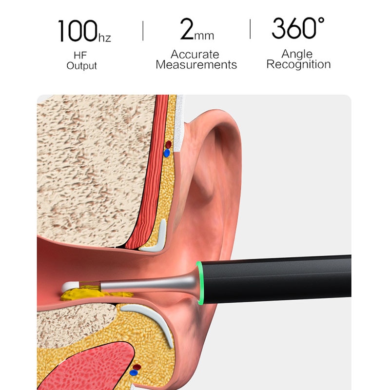 Oringal Bebird X17 Pro Smart Visual Ear Cleaning Endoscope In-Ear 300W ...