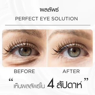 Smooth E Gold Perfect Eye Solution 15ML. เซรั่มบำรุงผิวรอบดวงตา ลดเลือนริ้วรอยและความหมองคล้ำ ผิวกระจ่างใส สมูทอี