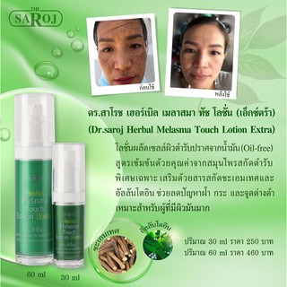 &gt;พร้อมส่ง&lt; ดร.สาโรช เฮอร์เบิล เมลาสมา ทัช โลชั่น (เอ๊กซ์ตร้า) 30ml / 60ml ครีมรักษาฝ้าสำหรับผิวมันมาก