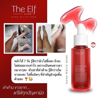 The Elf โดสแดง หัวเชื้อเร่งผิวขาว ตัวดังTikTok ร้านขายของแท้เท่านั้น‼️