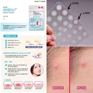(แท้ 💯 พร้อมส่ง) แผ่นแปะสิว OLIVE YOUNG Care Plus Spot Patch
