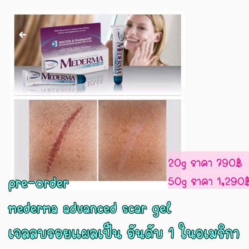 Mederma Advanced Scar Gel เจลลดรอยแผลเป็น