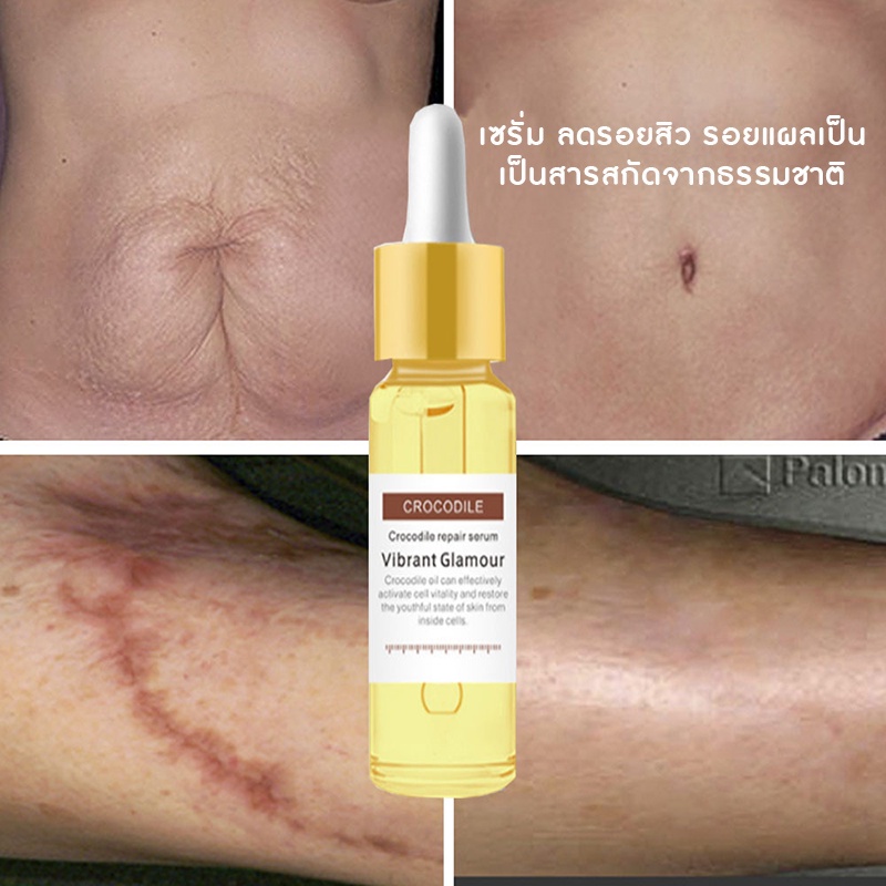 VIBRANT GLAMOUR ของแท้ 100% สูตร สกัดจากว่านหางจระเข้ Crocodile Repair Scar Face Serum Removal Acne 