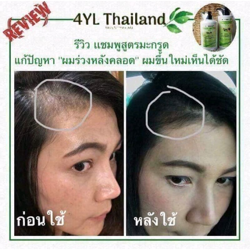 4YL Thailand แชมพูสมุนไพร จากสารสกัดธรรมชาติ