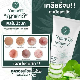 เจลใบบัวบก ญาตาวี Yatawee หลอด50g ช่วยซ่อมแซมและฟื้นฟูผิว ให้ผิวอิ่มน้ำไม่แห้งกร้าน ผิวไม่ลอกเป็นขุย ลด สิว จุดด่างดำ