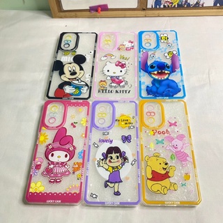 case xiaomi poco F3 เคส โพโค่ poco F3