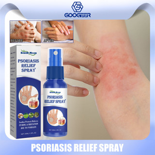 South Moon Psoriasis สเปรย์สมุนไพรธรรมชาติ บรรเทาอาการสะเก็ดเงิน โรคผิวหนังอักเสบ รักษาสุขภาพผิวหนัง ป้องกันการติดเชื้อ