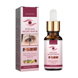 Stye Eye เซรั่มบํารุงรอบดวงตา 30 มล. สําหรับ Styes Chalazion Blepharitis Treatment Gentle