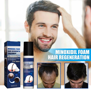 Minoxidil ทรีทเม้นท์บํารุงเส้นผม ความแข็งแรงพิเศษ สําหรับผู้ชาย