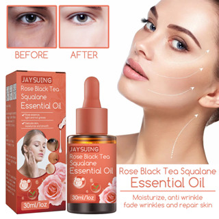 Rose Black Tea Squalane เซรั่มน้ํามันหอมระเหย ไวท์เทนนิ่ง ให้ความชุ่มชื้น ต่อต้านริ้วรอย