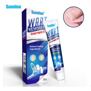 ของแท้ 100% Warts Remover ครีมกําจัดหูด ครีมบํารุงหูด พลาสเตอร์ข้าวโพด กําจัดไฝ เท้า