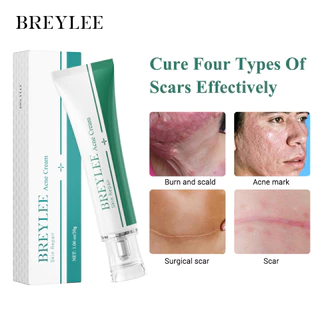 Breylee ครีมไวท์เทนนิ่ง ลดรอยแผลเป็นจากสิว 3 ชิ้น