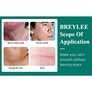 Breylee ครีมไวท์เทนนิ่ง ลดรอยแผลเป็นจากสิว 3 ชิ้น
