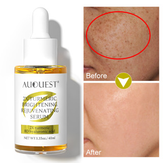 Auquest เซรั่มไวท์เทนนิ่ง Melasma และ Pekas Remover จุดด่างดํา สารต้านอนุมูลอิสระ ต่อต้านริ้วรอย กระชับรูขุมขน ขมิ้นชัน ไวท์เทนนิ่ง มอยส์เจอร์ไรซิ่งเอสเซ้นส์ 40 มล.