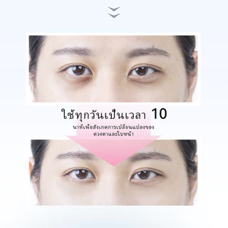 ANLAN เครื่องนวดใต้ตา เครื่องนวดผิวรอบดวงตาระบบสั่น EMSลดรอยคล้ำ ตาแพนด้า ลดบวม บําบัดถุงใต้ตา ลดรอยคล้ําใต้