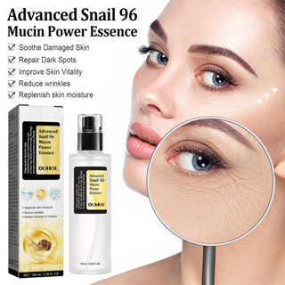 Advanced Snail 96 Mucin Power Essence เอสเซ้นบํารุงผิวหน้า ต่อต้านริ้วรอย 100 มล.