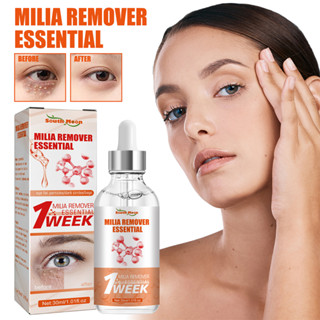 Milia Remover เอสเซ้นบํารุงรอบดวงตา เซรั่มบํารุงรอบดวงตา ต่อต้านริ้วรอย ให้ความชุ่มชื้น ลดไขมัน 30 มล.