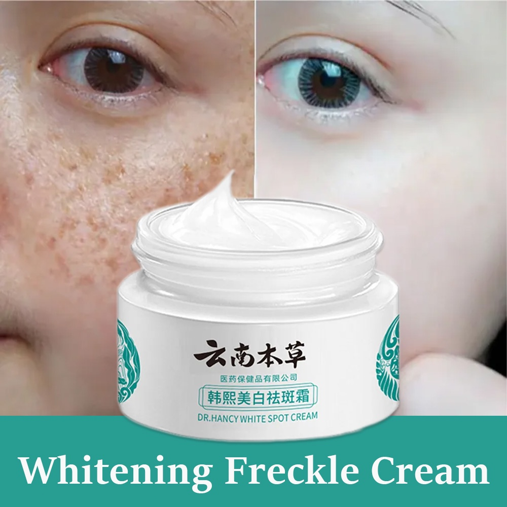 2023จีนของแท้ Melasma ครีม White Spot Cream Skin Care Face Moisturizer Freckle Whitening Cream