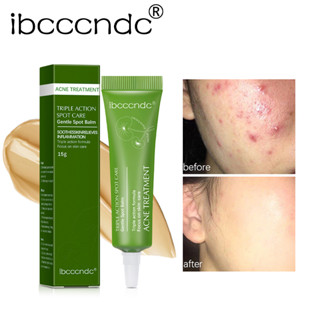 Ibcccndc Acne Plus Triple Action Spot Caregentle Spot บาล์มบํารุงผิวหน้า| ป้องกันรอยแผลเป็นจากสิว | ยางลบสิวเสี้ยน | ซ่อมแซมรอยแผลเป็น | ผลิตภัณฑ์ดูแลผิว 15 กรัม