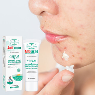 Aichun Beauty-Acne ครีมบํารุงผิวหน้า M183