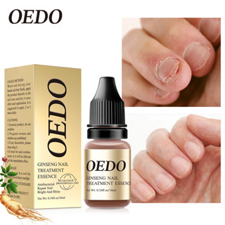 OEDO FDA รักษาเชื้อราเล็บ ยาทาเชื้อราเล็บ เชื้อราที่เล็บ รักษาเล็บ เชื้อราที่เล็บ รักษาเล็บขบ ฆ่าเชื้อราที่เล็บ 10ml