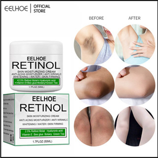 EELHOE Retinol Cream Whitening Cream Lotion Body Private Parts Lightening Underarm Armpit Legs Knees 10/20/30/50Ml M01-Eelhoe