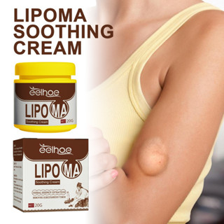 Lipoma ครีมสมุนไพร บรรเทาอาการปวด