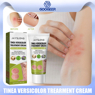 South Moon Tinea Versicolor Repair Ointment Hand Body Tinea Anti-Itch ครีมทามือ ลดโรคสะเก็ดเงิน จากธรรมชาติ ครีมรักษาโรคกลาก หนอนวงแหวน ครีมบํารุงผิวมือ บรรเทาอาการคัน (56 กรัม/กล่อง)