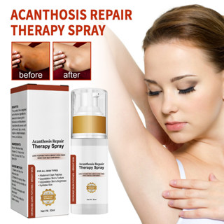 Dilute Acantho Clear therapy spray, Gfouk acanthosis Nigricans therapy spray, สเปรย์รักษาโรคข้ออักเสบ, รักษาจุดด่างดํา, น้ํามันแก้ไขจุดด่างดํา, ไวท์เทนนิ่งถาวร