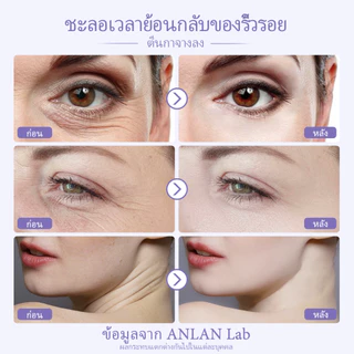 ANLAN เครื่องนวดหน้ายกกระชับ นวดใต้ตาได้ เครื่องผลักครีม EMS/สั่นสะเทือน ทำความสะอาดรูขุมข ยกกระชับผิว กำจัดถุงตา สำหรับ20ปี+ ผู้หญิง