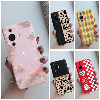 สําหรับ Huawei nova 11 11i เคสแฟชั่น ลายตารางหมากรุก นิ่ม TPU ซิลิโคน เคสขนม