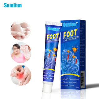 Sumifun ครีมกําจัดกลิ่นเท้า กําจัดเชื้อรา คัน แห้ง และเท้าเป็นขุย ตุ่มน้ํา ฉี่ หมุน