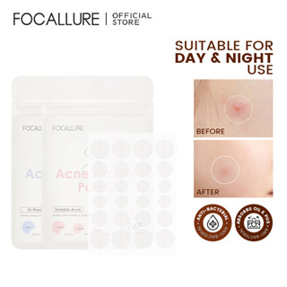 Focallure แผ่นแปะสิว กันน้ํา รักษาฝ้า ดูแลผิว ซ่อมแซมสิว ใส