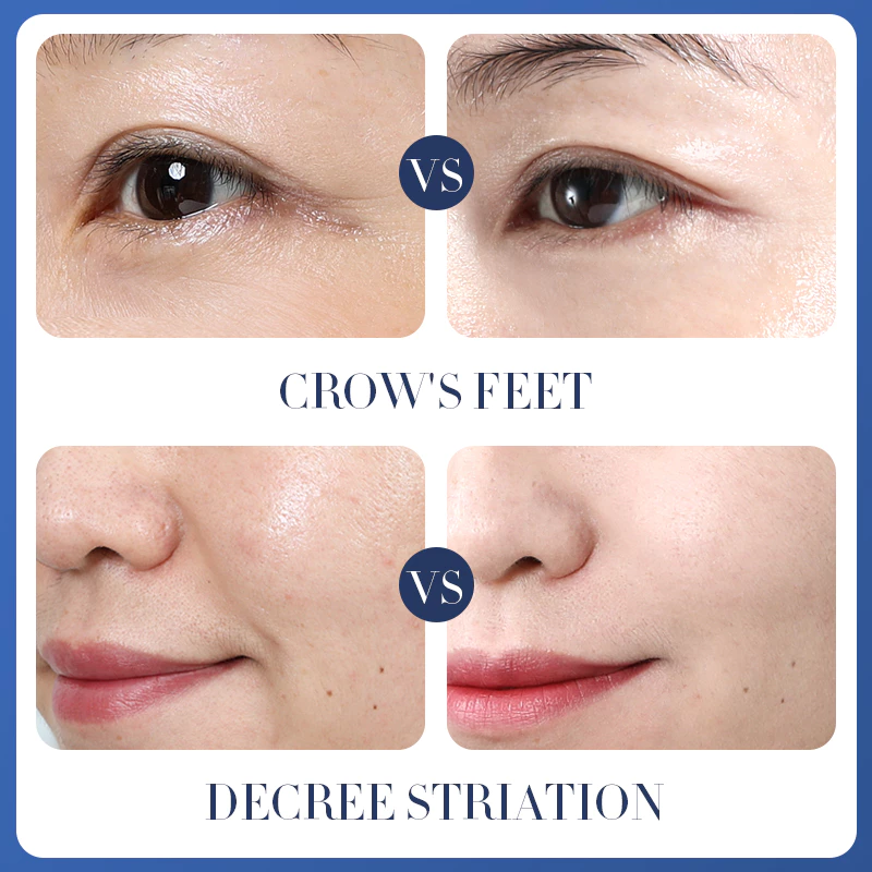BIOAOUA มาส์กหน้าคอลลาเจน ไฮยาลูรอน วิตามินซี ผิวนุ่ม ใสขึ้น thumbnail 8