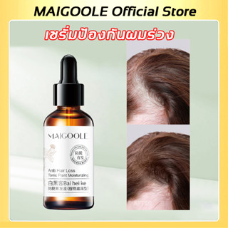 MAIGOOLE Official Store น้ำยาปลูกผม เซรั่มปลูกผม 60g ซ่อมแซมผมเสีย เร่งผมยาว ป้องกันผมร่วง ป้องกันผมร่วงอย่างมืออาชีพ แก้ปัญหาผมร่วง ลดผมร่วง