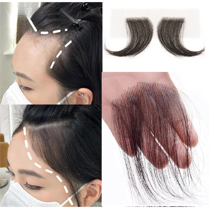 คู่ผมมนุษย์ Fine Traceless Baby Hair Loss Cover Hairline สําหรับผู้หญิงความยาว 15 ซม.