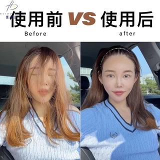 [มิมินาโตะ]หวีเสียบผมหน้าผาก แบบมองไม่เห็น สําหรับผู้หญิง🔥 รวมภาษีแล้ว