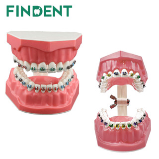 Typodonts โมเดลการสาธิตการจัดฟัน พร้อมลวดโลหะ และการเรียนการ…