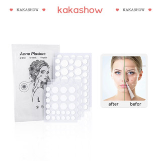 kakashow แผ่นสติกเกอร์ไฮโดรคอลลอยด์ กําจัดสิวเสี้ยน ดูแลผิว 36 ชิ้น HZMBB2151