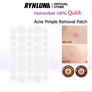 Rynluna แผ่นไฮโดรคอลลอยด์ กําจัดสิว 100% AC 36 ชิ้น