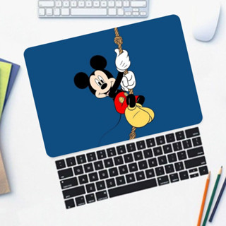 【Mickey】For Macbook case M2 Air15 Air13.6 New Macbook 2021 Pro14 pro16  Air 13.3 A2179 A2337 2018 Pro 13 15 touch bar A1706 A1932 A1466 Cartoon Cover A1708 Reina13