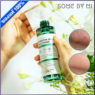 SOME BY MI AHA BHA PHA 30 Days Miracle Toner 150 ml โทนเนอร์ซัมบายมี ซัมบายมี โทนเนอร์ เหมาะสำหรับผิวมัน กระชับรูขุมขน