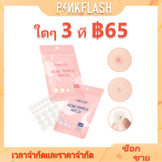 Pinkflash แผ่นแปะรักษาสิว รักษาฝ้า จุดด่างดํา ซ่อมแซมผิว